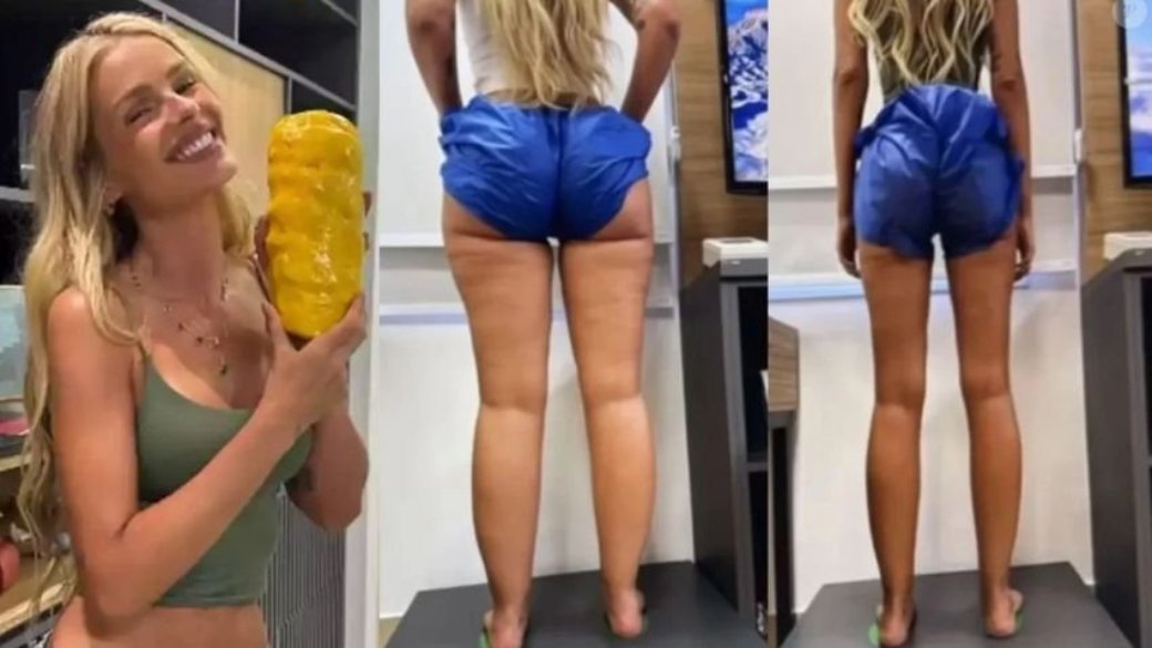 Lipedema-Yasmun-Brunet-capa